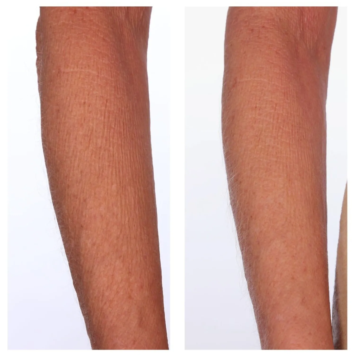 U BEAUTY Beauty The Sculpt Arm-Compound
