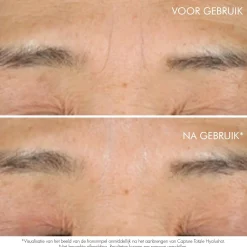 DIOR Leg Totale Hyalushot Vast
