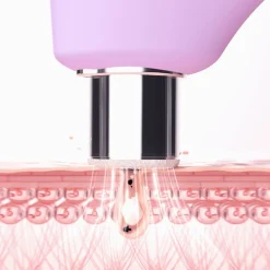 FOREO Kiwi Derma Diamant Microdermabrasie & Porien Reinigingsapparaat