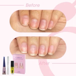 Herome Cosmetics Handverzorging Nail Essentials Set Na Kunstnagels Of Medicijngebruik (Roze) - Full-Size