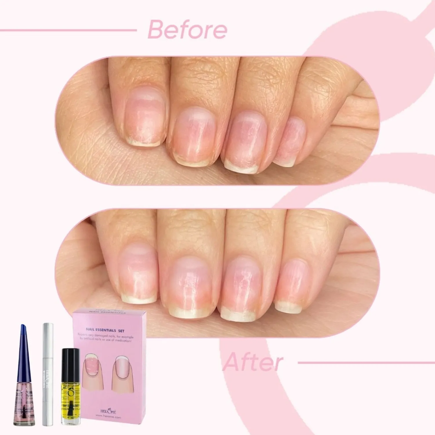 Herome Cosmetics Handverzorging Nail Essentials Set Na Kunstnagels Of Medicijngebruik (Roze) - Full-Size