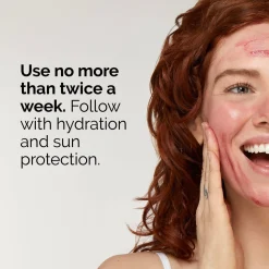 The Ordinary Even Skin Tone Aha 30% + Bha 2% Peeling Solution